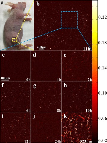 Fig. 12