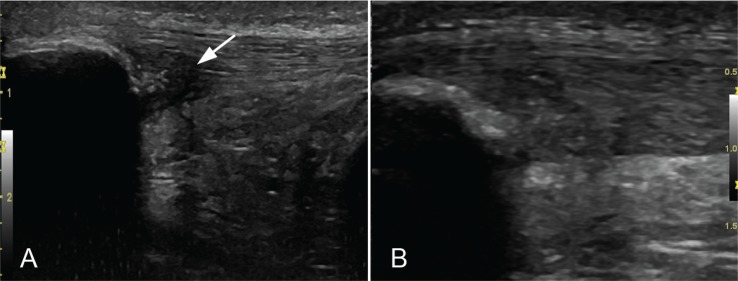 Figure 2 A–B.