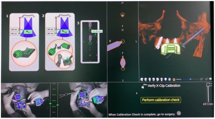 Figure 25