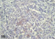 Figure 1B