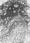 83