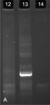 Figure 1A