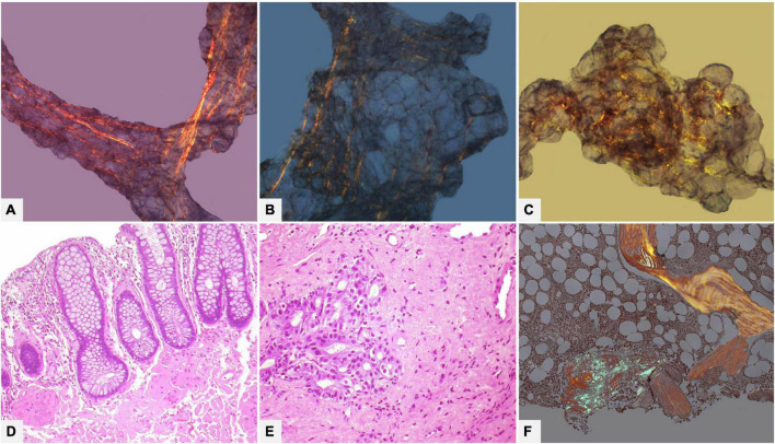 FIGURE 10