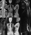 Fig. 1 A-H