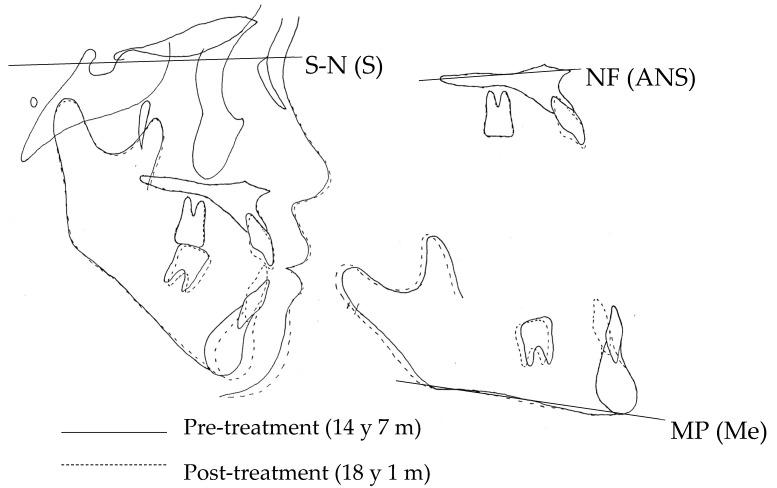 Figure 13