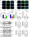 Figure 3. F-PRT preserves the expression of AQP5 compared with that of S-PRT. A and C, Immunofluorescent staining for AQP5 (green) representing the expression of AQP5 at 5 and 14 days, respectively following 16 Gy irradiation of F-PRT versus S-PRT. 100X magnification, scale bar, 100 μm. B and D, Quantification of immunofluorescent detection of salivary gland AQP5 expression, after 5 days and 14 days, respectively after irradiation with 16 Gy PRT. n = 4, mean values compared using Welch t test. E and F, Relative mRNA expression of AQP5 from the submandibular gland (n = 4) at 2 and 14 days after irradiation with S-PRT/F-PRT. Statistical analysis Welch t test. G, Western blot analysis and their corresponding quantification of the expression of AQP5 from the submandibular gland (n = 4) at 2, 5, 10, and 14 days following irradiation with 16 Gy of S-PRT/F-PRT. Mean difference between groups compared by Welch t test.