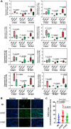Figure 4. F-PRT induces lower levels of inflammatory cytokines in submandibular glands compared with S-PRT. A, Multiplex cytokine analysis on submandibular gland lysates at 2, 10, and 28 days after irradiation with 16 Gy of PRT. Values represent mean ± SEM (n = 3 for NR and n = 5 for S-PRT/F-PRT). The difference between means from different groups was estimated using a mixed-effects model. B, Immunofluorescent evaluation of TGFβ1 in mouse submandibular gland irradiated with S-PRT or F-PRT. C, Quantification of TGFβ1 signal in the submandibular gland 28 days after irradiation with PRT. n = 5, with 5 sections for each mouse of NR and seven sections for each mouse of S-PRT and F-PRT; mean values compared using Welch t test.