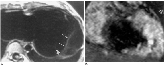 Fig. 11