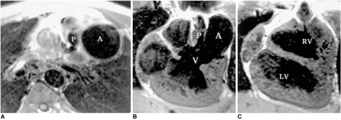 Fig. 13