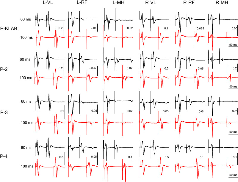 Figure 13.