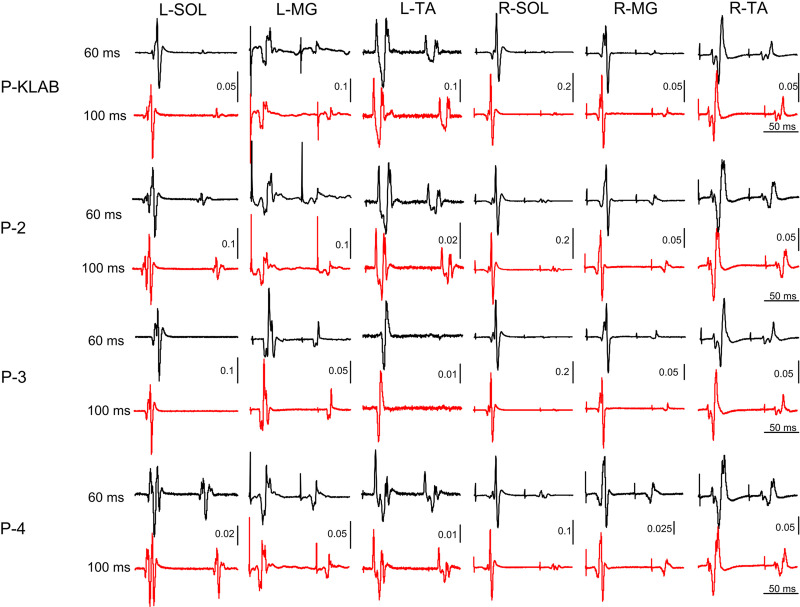 Figure 12.