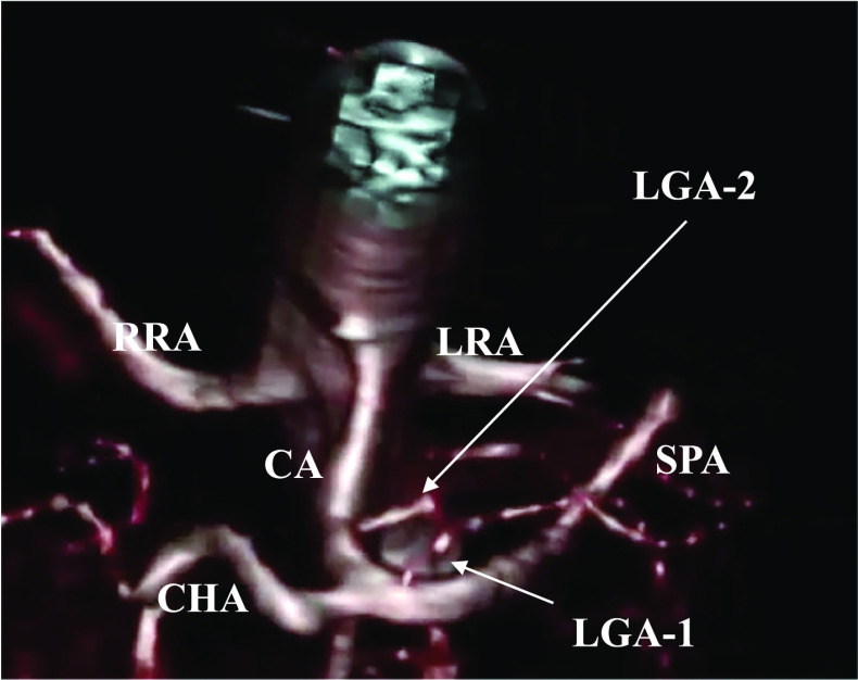 Fig. 2