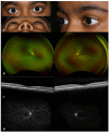 Fig. 4