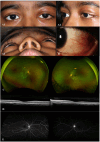 Fig. 3