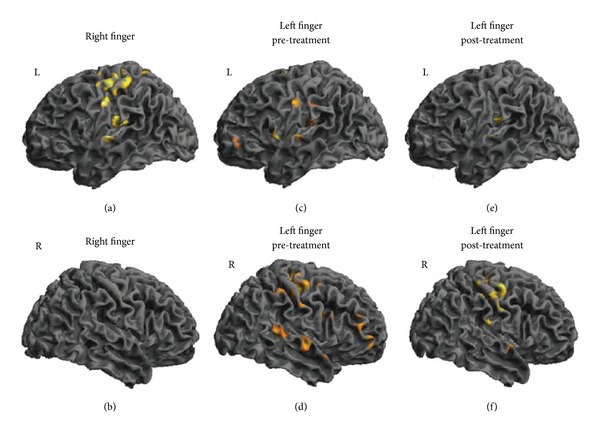 Figure 12