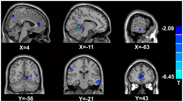 FIGURE 3