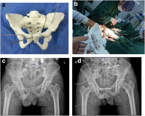 Fig. 2