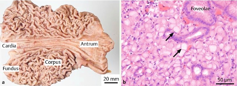 Fig. 2 a