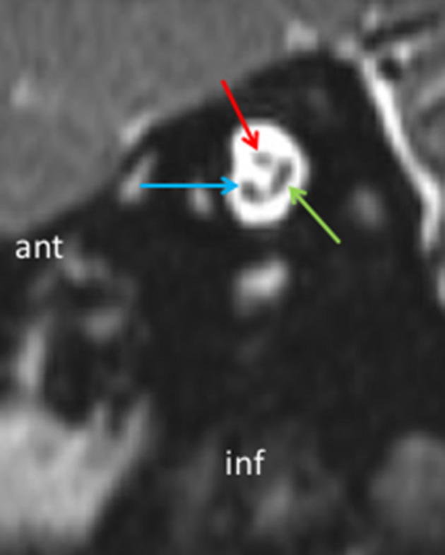 Figure 2.