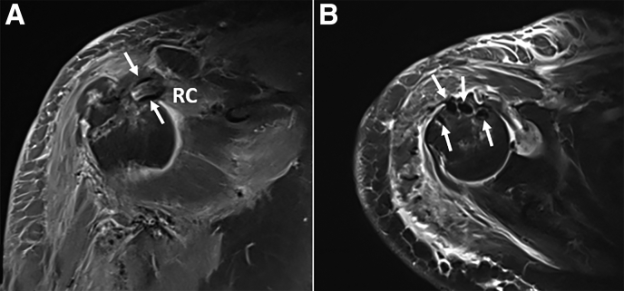 Fig 17