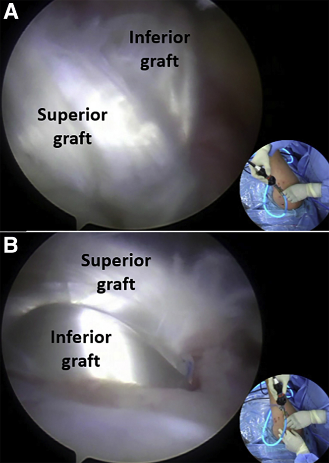 Fig 13