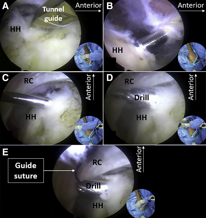 Fig 4