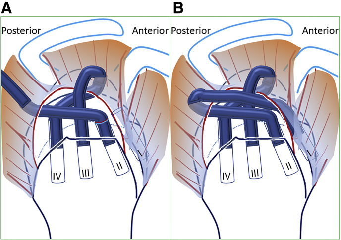 Fig 12