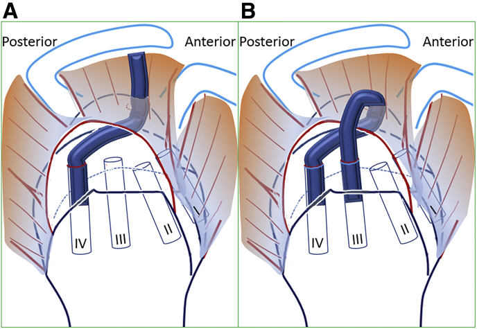 Fig 10