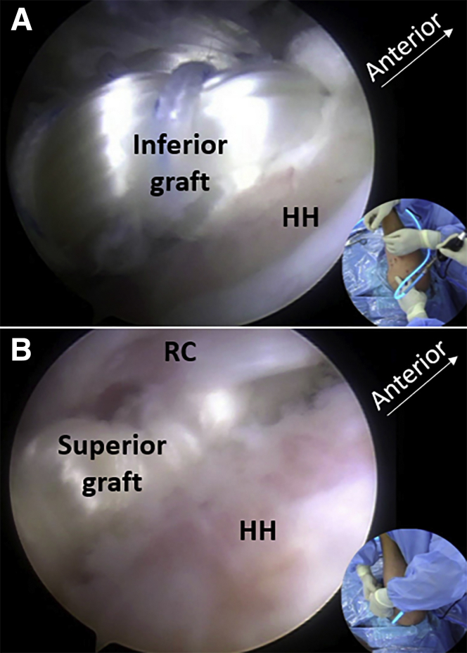 Fig 11