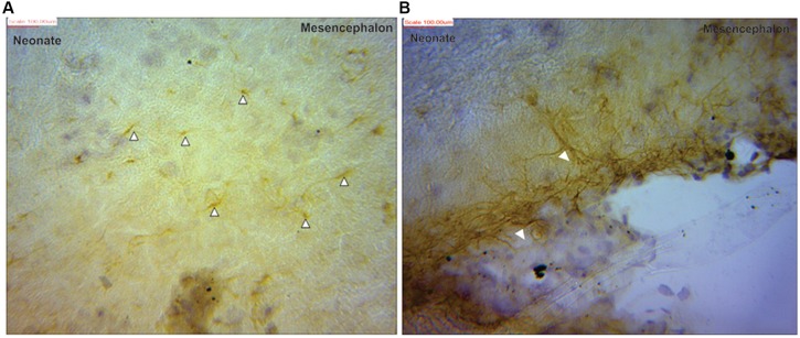 FIGURE 3