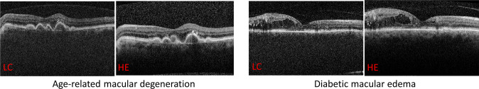 Fig. 2