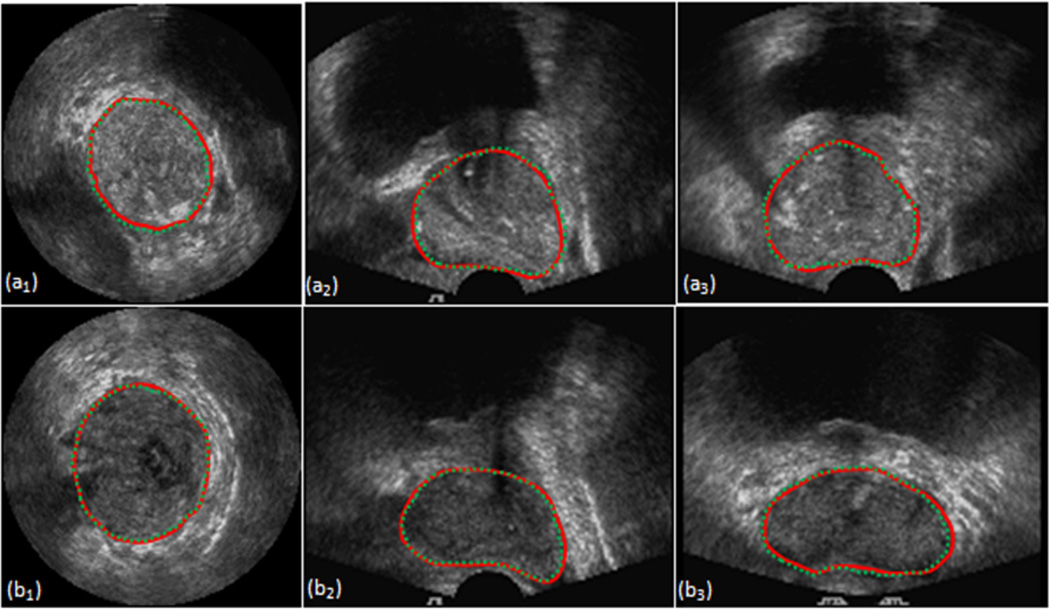 Figure. 3