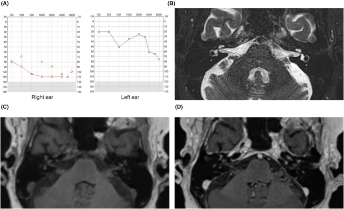 FIGURE 2