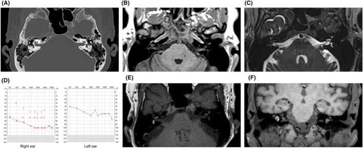 FIGURE 1