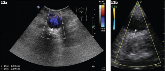 Fig. 13