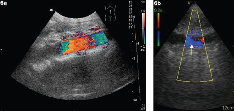 Fig. 6