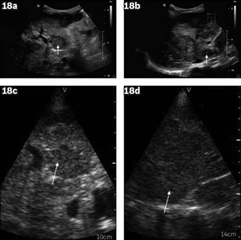 Fig. 18