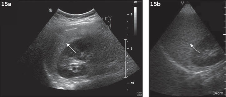 Fig. 15