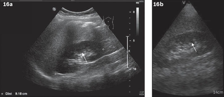 Fig. 16