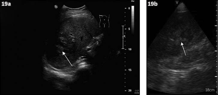 Fig. 19