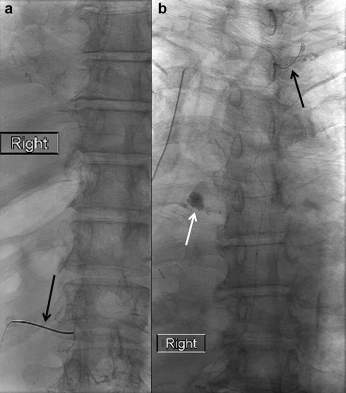 Fig. 14