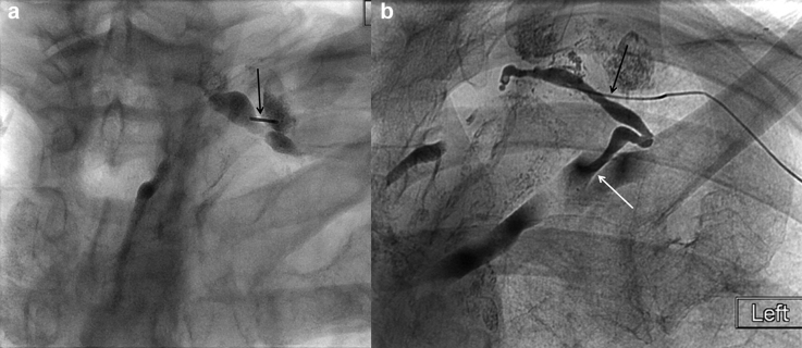 Fig. 17