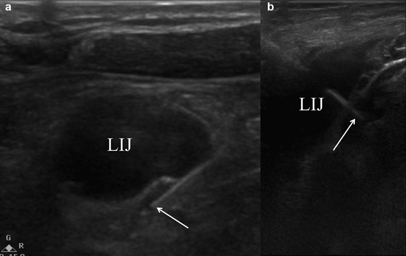 Fig. 16