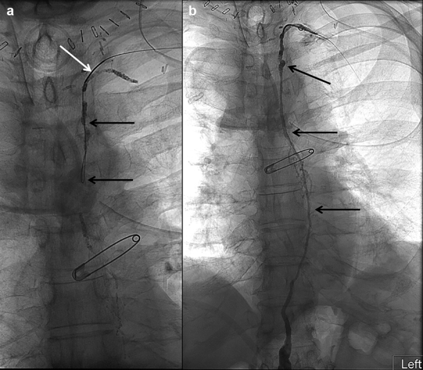 Fig. 18