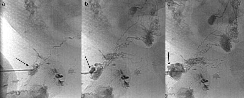 Fig. 11