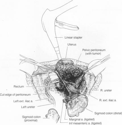 Figure 12.