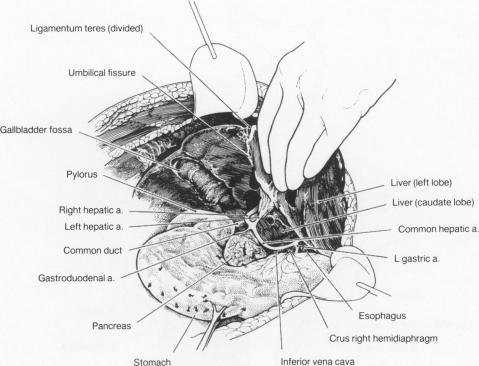 Figure 10.