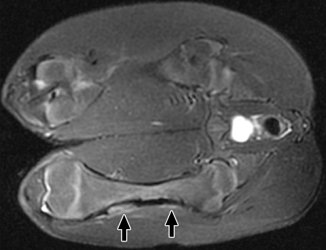 Figure 2a: