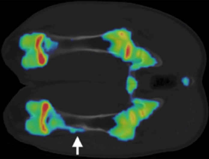 Figure 5b: