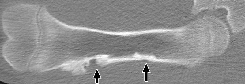 Figure 4b: